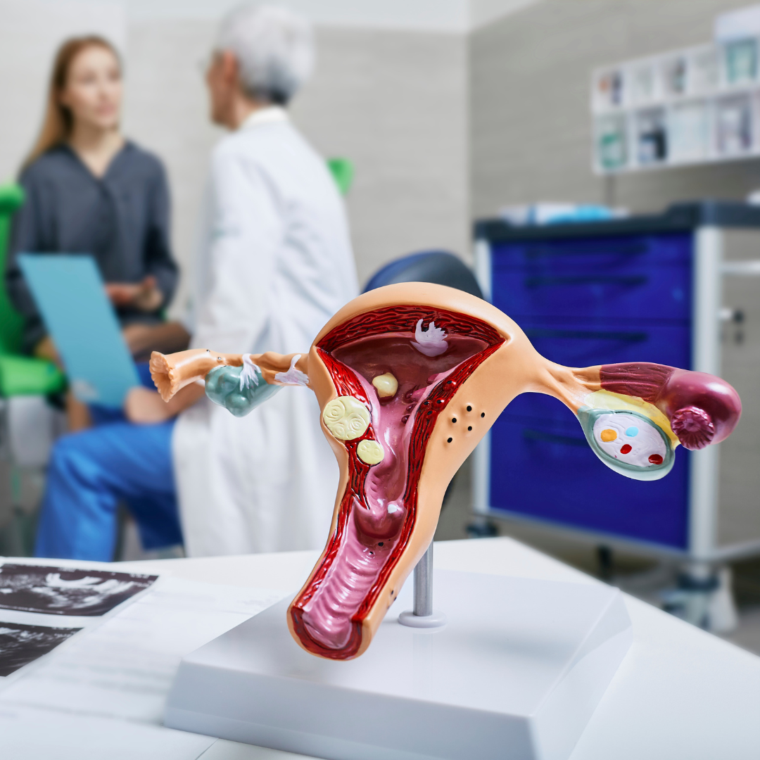 A model of a womans reproductive organs on a background of a consultation A model of a womans reproductive organs on a background of a consultation